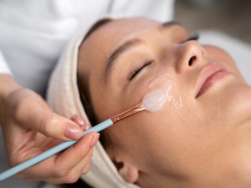 A brush applying a peel solution to a patient's cheek